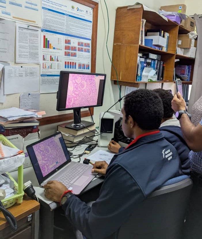 A Practical Telepathology Setup in Papua New Guinea
